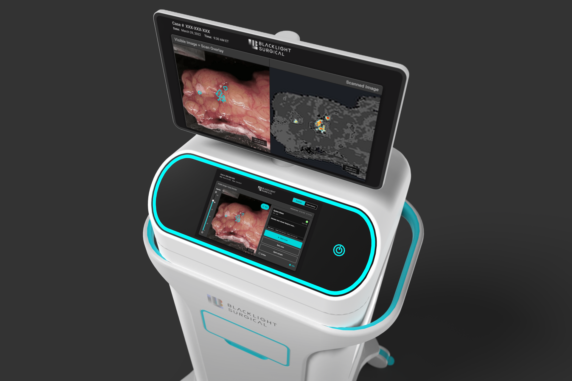 A 3D rendering of BlackLight Surgical's advanced intra-operative tissue pathology medical device cart with dual screens displaying user interface, tissue pathology imagery, and diagnostic data.