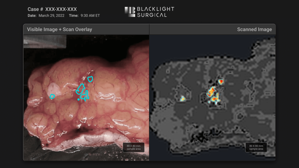 Medical imaging comparison displaying a visible image with scan overlay next to a scanned image highlighting specific areas of interest.