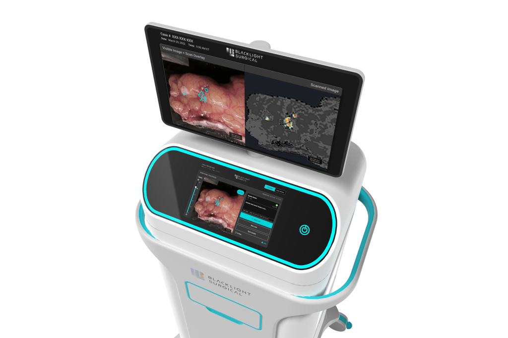 A 3D rendering of BlackLight Surgical's advanced intra-operative tissue pathology medical device cart with dual screens displaying user interface, tissue pathology imagery, and diagnostic data.
