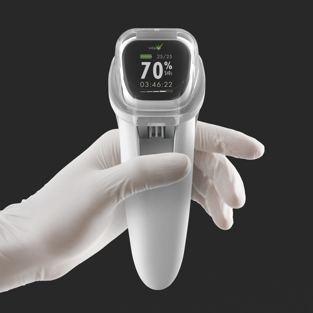 A gloved hand holding the ViOptix Intra.Ox handheld tissue oxygenation monitor with read out on the screen.