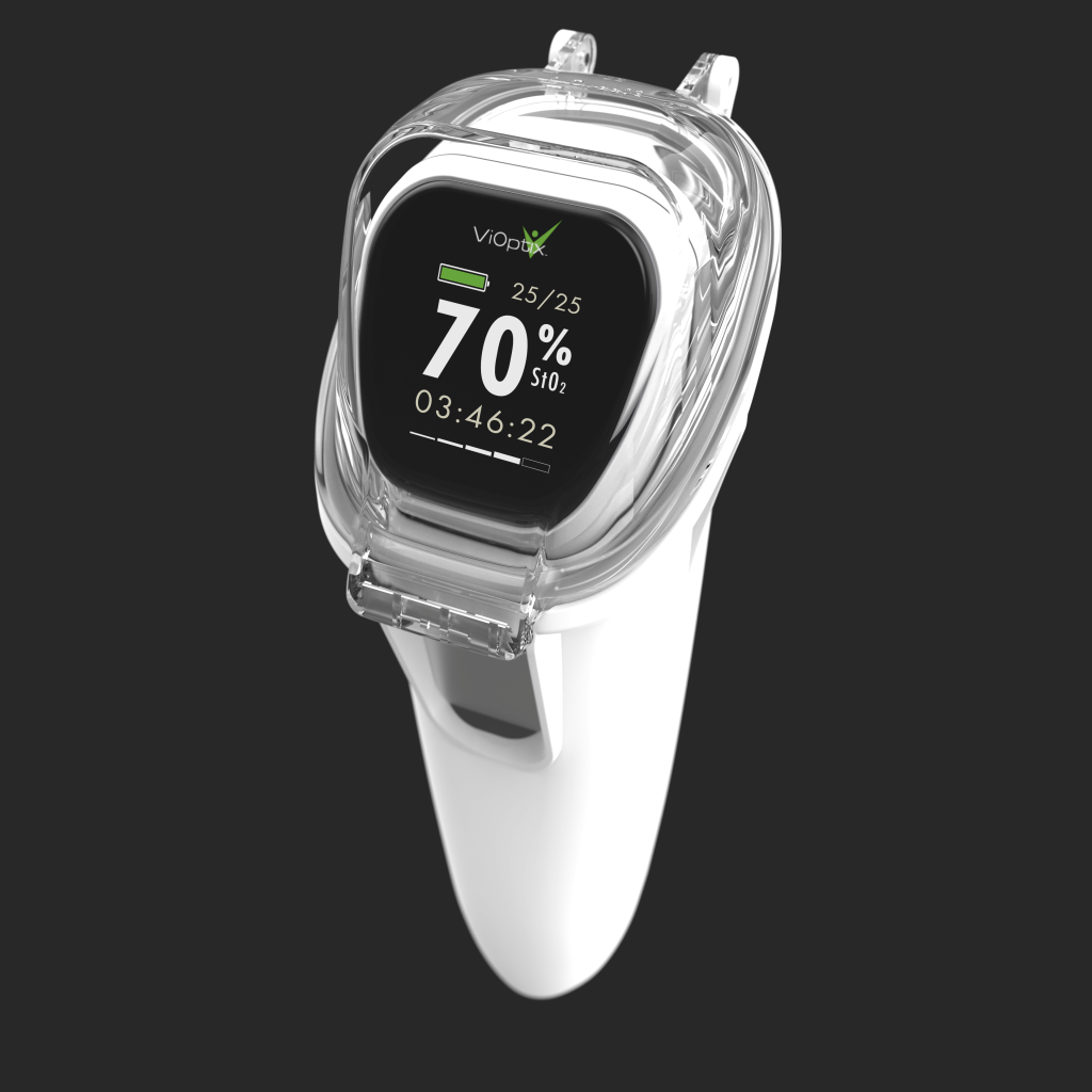 A 3D rendering of the ViOptix Intra.Ox handheld tissue oxygenation monitor with read out on the screen.