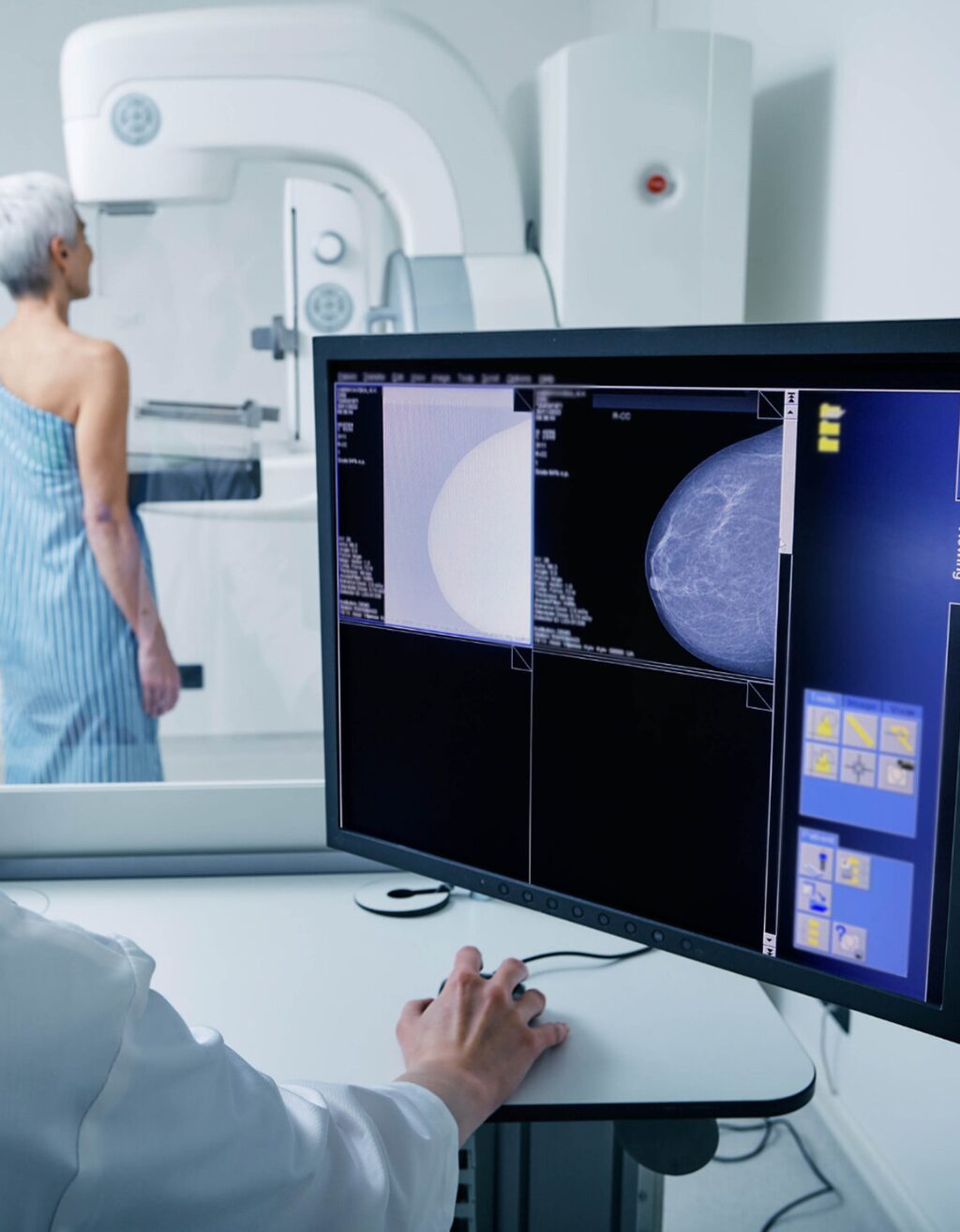 From novel imaging devices for breast cancer detection to upright radiation therapy systems for treatment