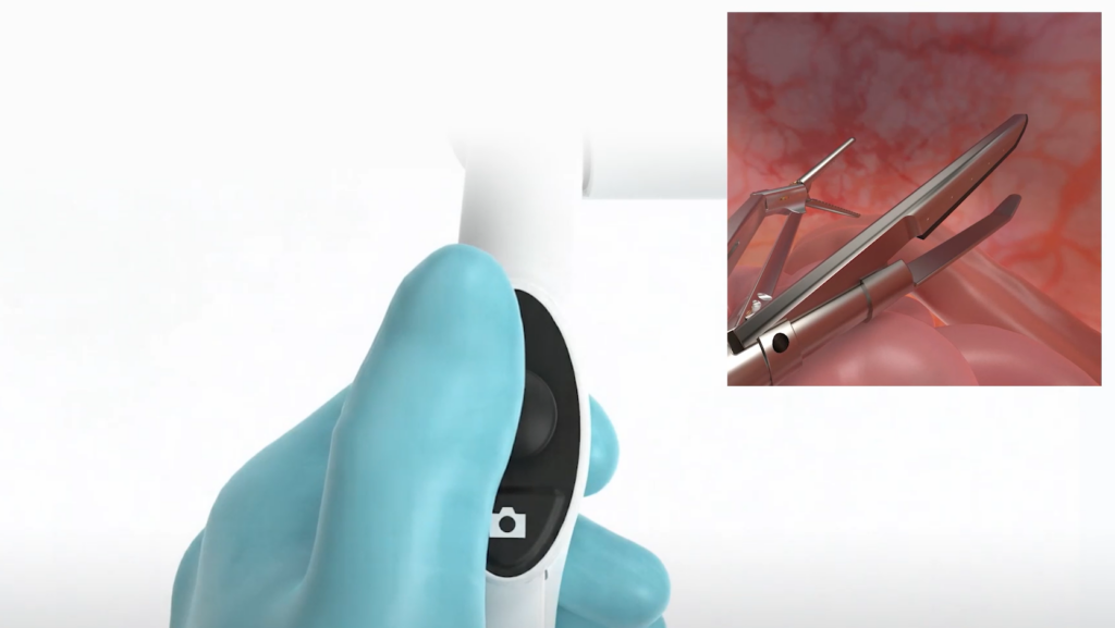 A gloved hand holds a camera control on the handle, while an inset shows a surgical tool near internal tissue.